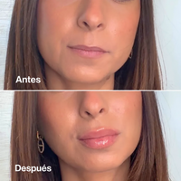 Dúo Lip Volume + Lip Stain